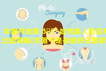 丰眉弓效果 🌲 如何真人前后对比图揭秘(丰眉弓是硅胶好还是膨体的好)